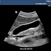 GALLBLADDER